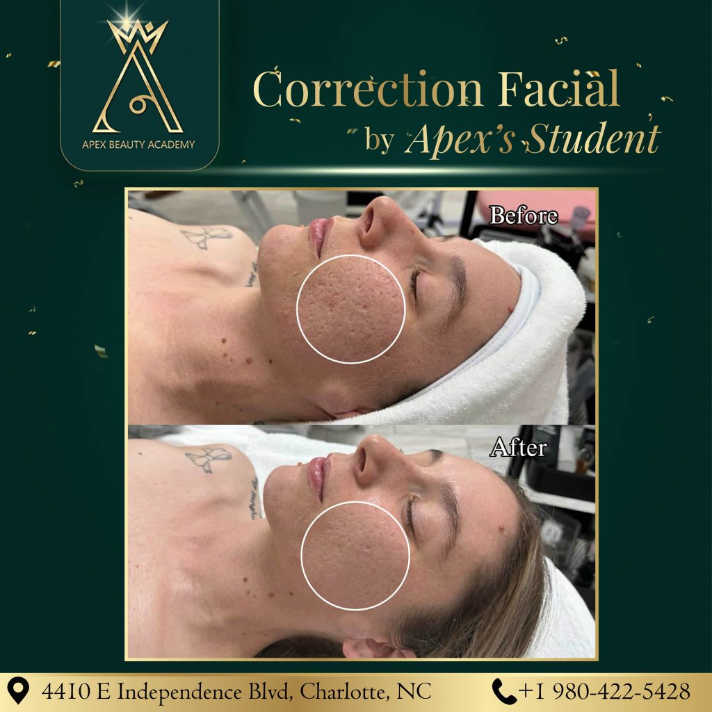 Esthetic course in NC