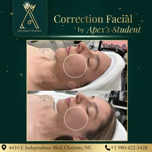 Esthetic course in NC